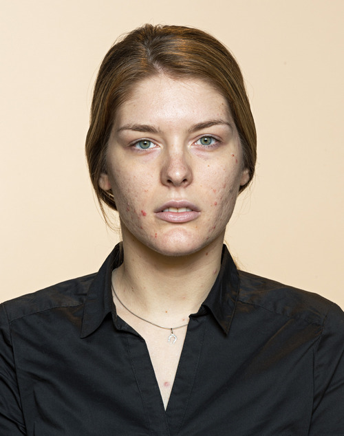 EUC DermoPure Beauty shot sep2017 02a